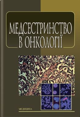 Медсестринство в онкології: підручник (ЗНЗ І—ІІІ н. а.) / Л. М. Ковальчук, О. М. Парійчук, І.І. Романишин та ін.; за ред. К. М. Ковальчука. — 2-е вид., випр. - Медицина