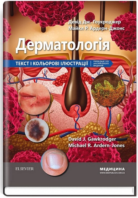 Дерматологія. Текст і кольорові ілюстрації - фото 1