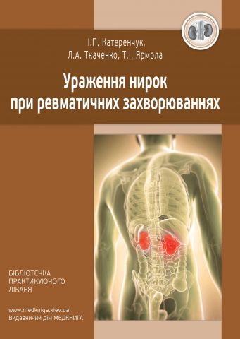 Ураження нирок при ревматичних захворюваннях - фото 1