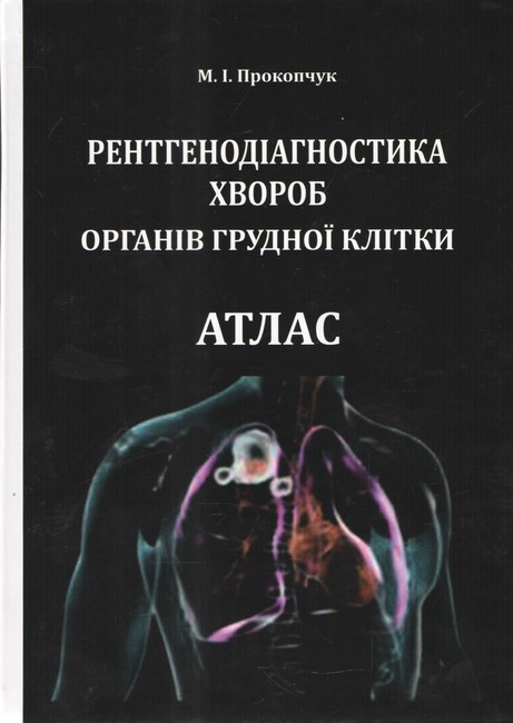 Рентгенодіагностика хвороб органів грудної клітки Атлас Авт: М.І. Прокопчук Вид-во: Видавництво Бона - фото 1