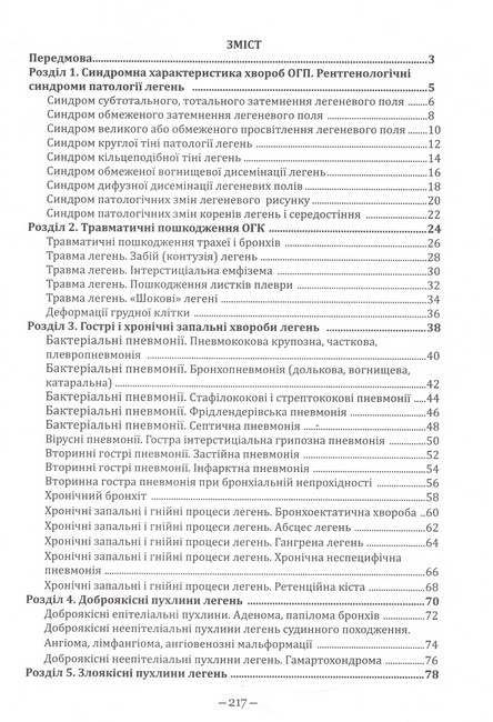 Рентгенодіагностика хвороб органів грудної клітки Атлас Авт: М.І. Прокопчук Вид-во: Видавництво Бона - фото 2
